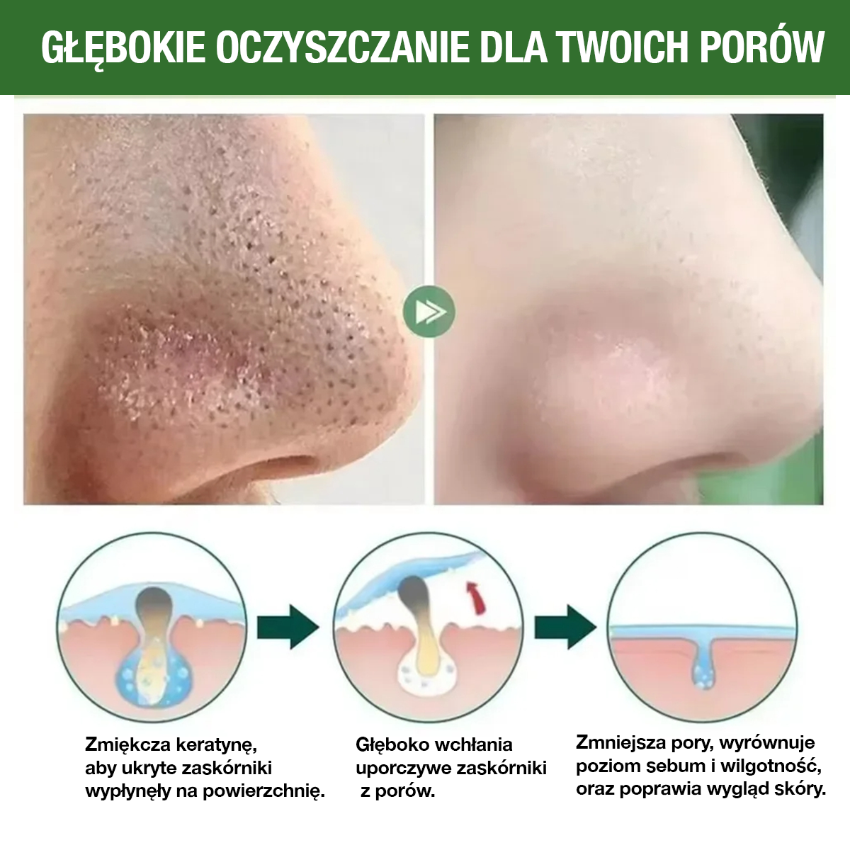 GreenMask® – Głębokie oczyszczanie twarzy (Kup 1, otrzymaj 2 🎁)