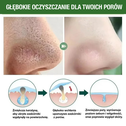 GreenMask® – Głębokie oczyszczanie twarzy (Kup 1, otrzymaj 2 🎁)